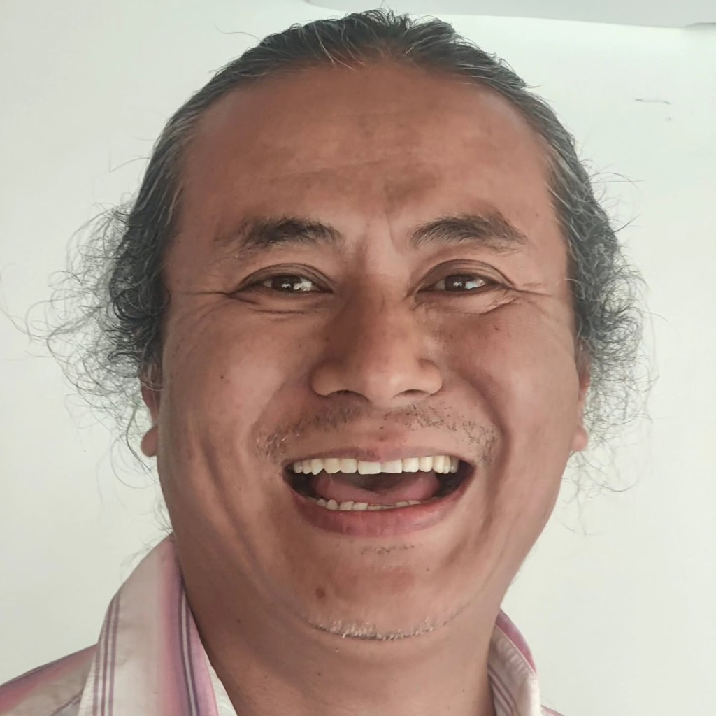 Smile Restoration — after