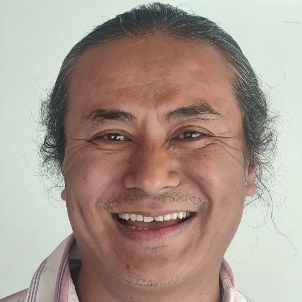 Smile Restoration — before